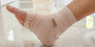 ankle sprain treatment Edmonton