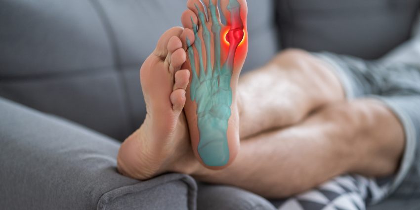 plantar fasciitis Edmonton