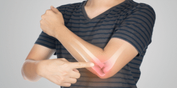 tennis elbow treatment Edmonton